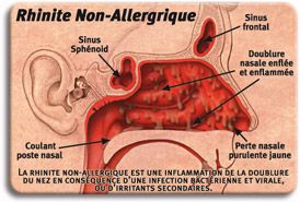 coulement nasal par l'arrire